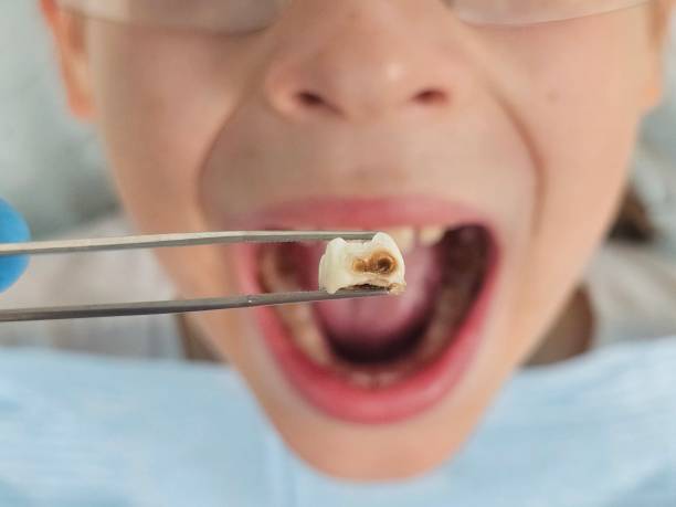 Best Cosmetic Emergency Dentistry in Clear Lake, WI